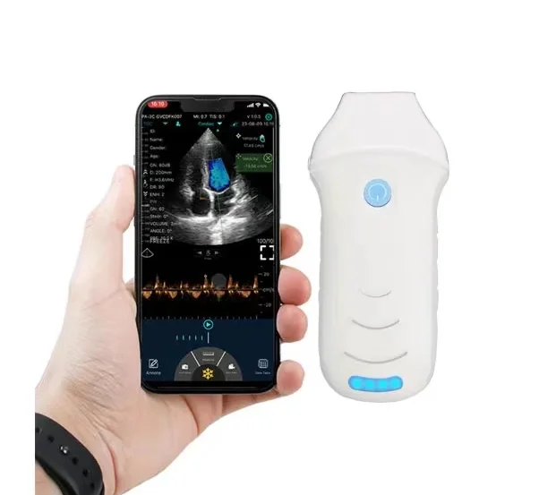 MC29 Highest configuration expert wireless CW phased array ultrasound probe scanner for cardiac and abdomen