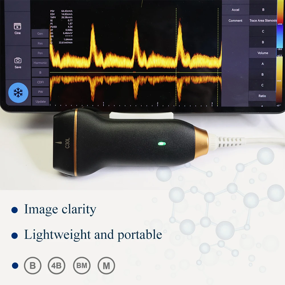 Ultrasonic Linear Probe Wireless Ultrasonic Handheld Ultrasound Scanner for use with mobile phones