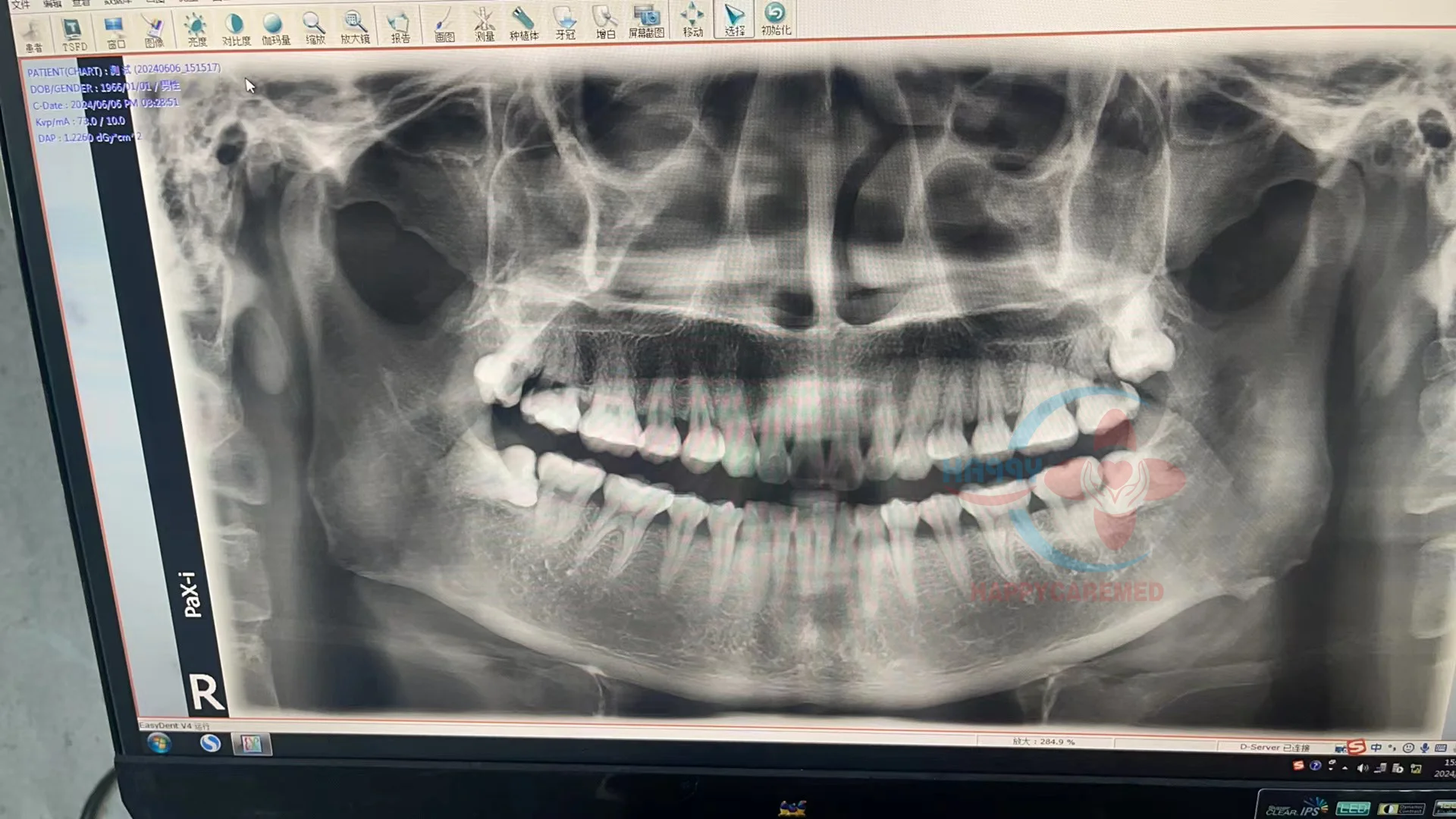 Used   Panoramic Dental  portable x ray machine