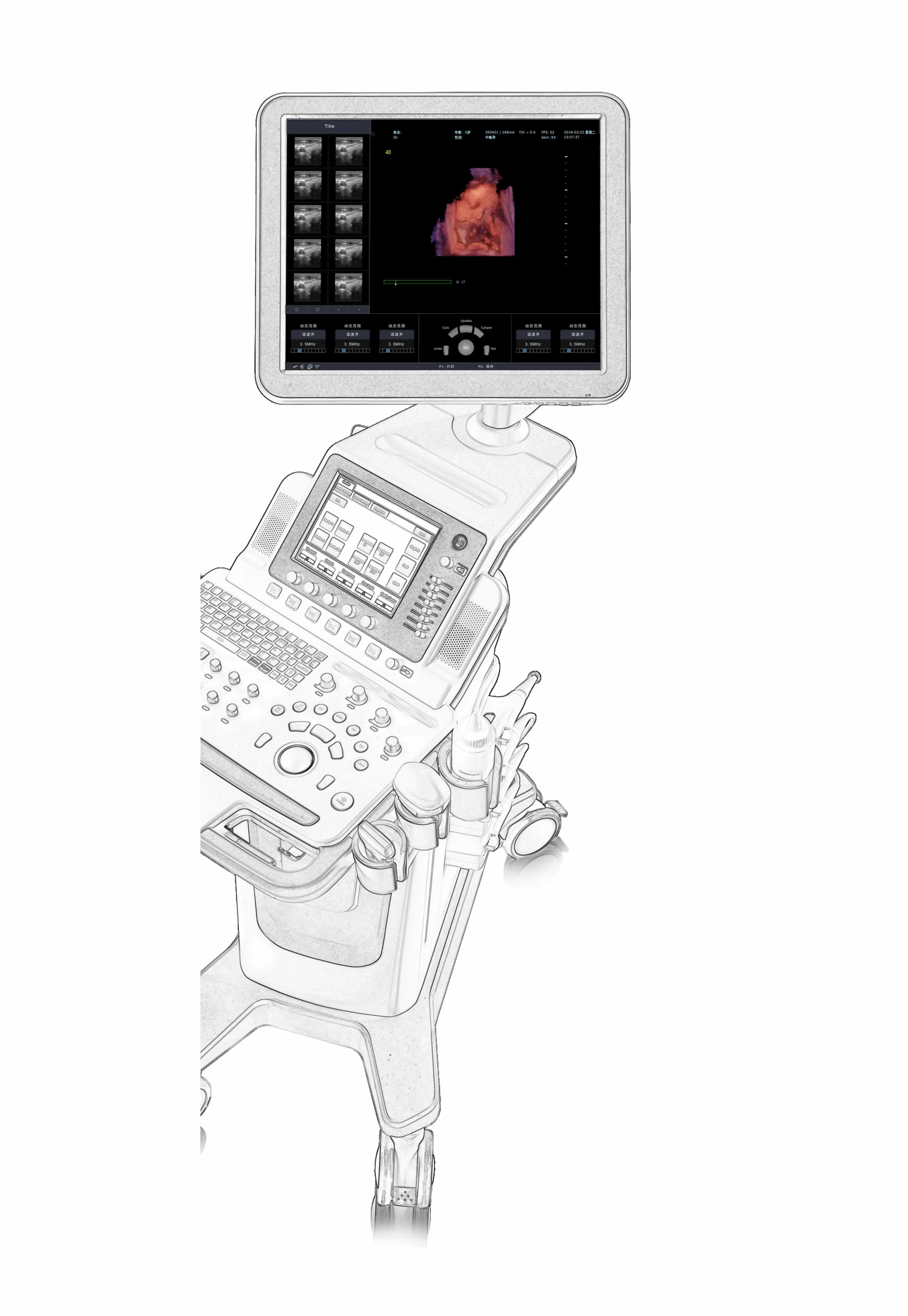 Best sell Trolley 4D Cardiac Probe Color Doppler Ultrasound Machine