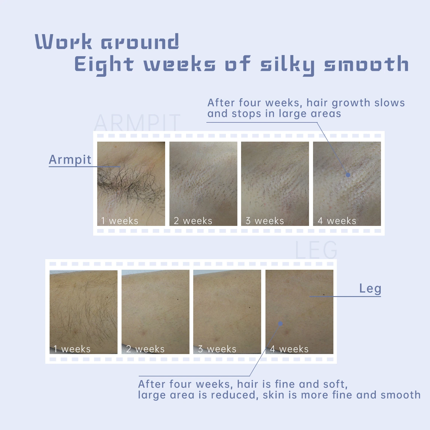 Mlay high-end home beauty instrument can turn on off the cooling function hair removal instrument at will