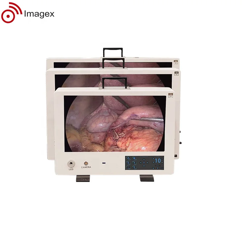 Integrated All in one Telepack Camera System for Arthroscopic Surgeries