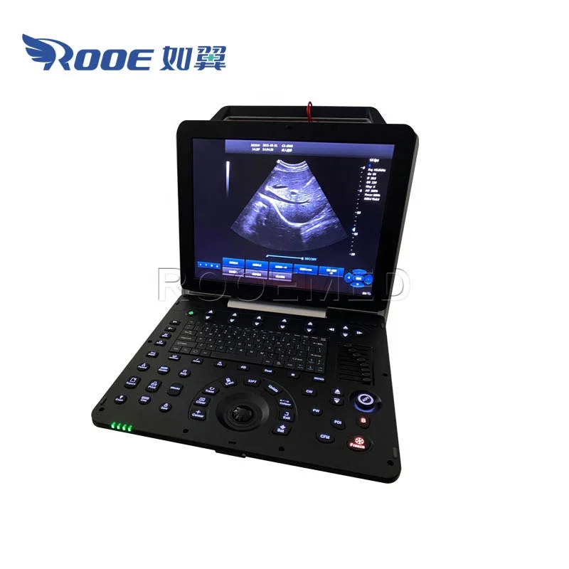 USC300PRO Medical Portable Scan Cardiac Color Doppler Ultrasound