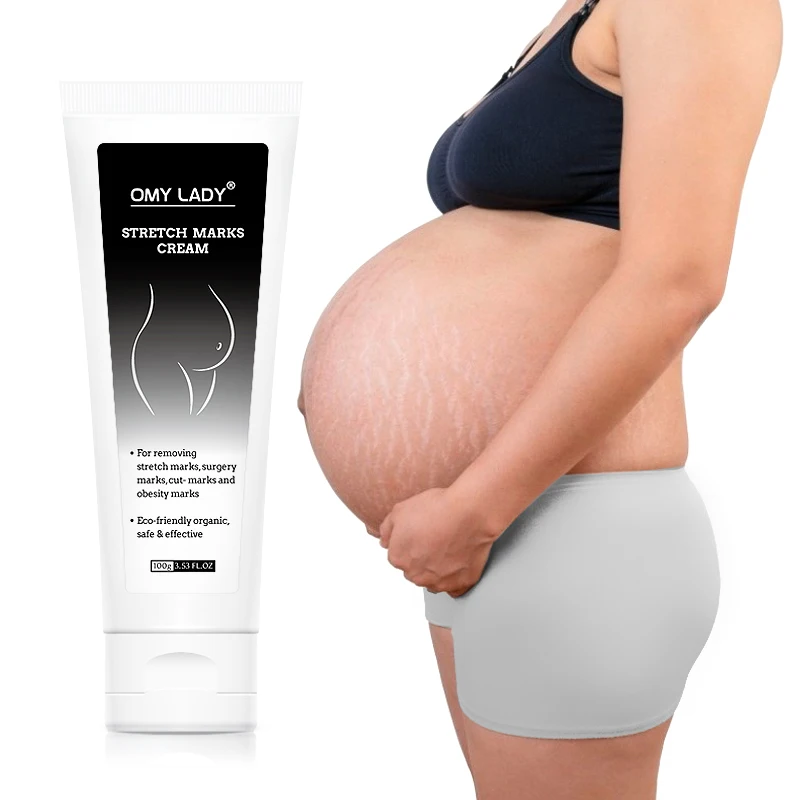 Лидер продаж, Камбоджа, крем для удаления шрамов и темных следов от растяжек для беременных