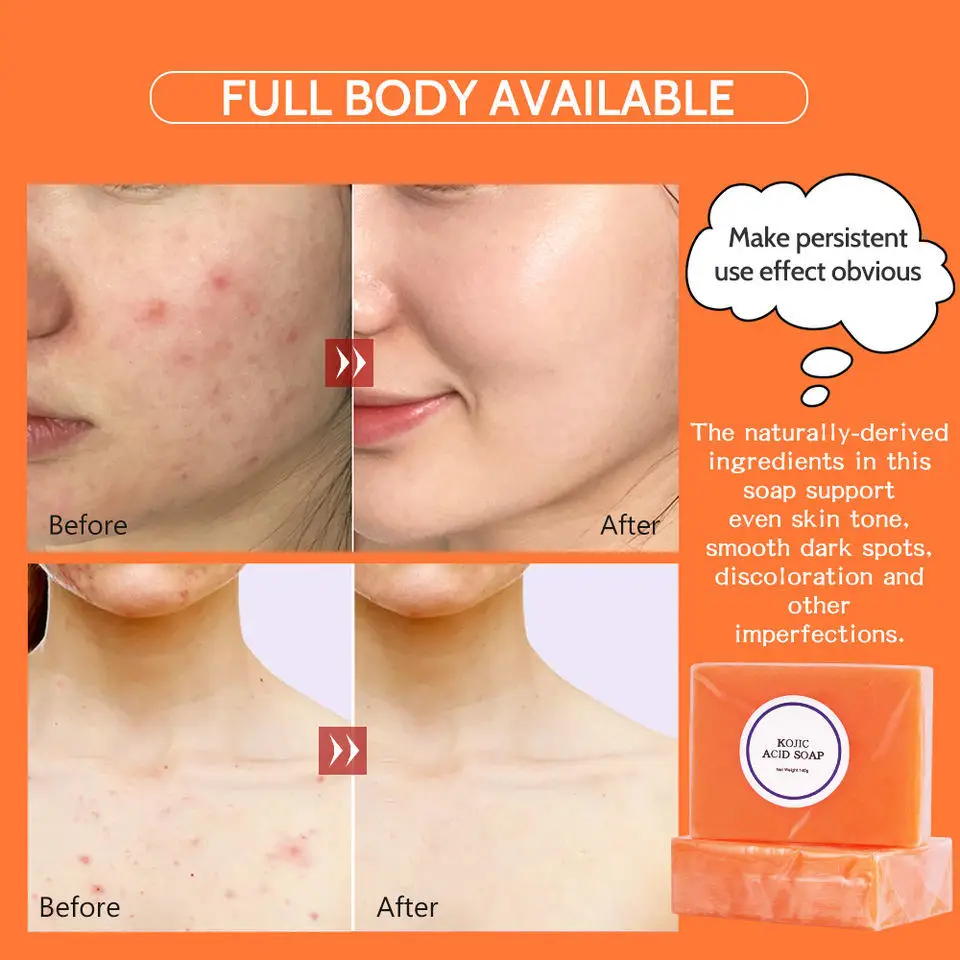 Bleaching Soap Solid Kojic Acid Soap Cosmetics Body for Skin Whitening Lightening