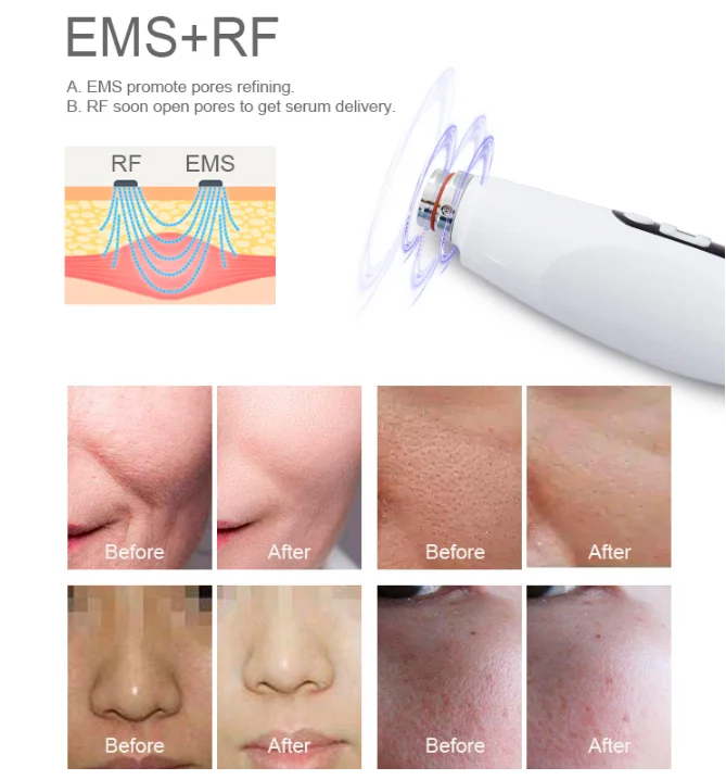 H9 EMS Microneedle Meso Gun Mesothrapy Wrinkle Removal RF No Needle Injection Face Lift Machine Moisturizing Mesotherapy Gun