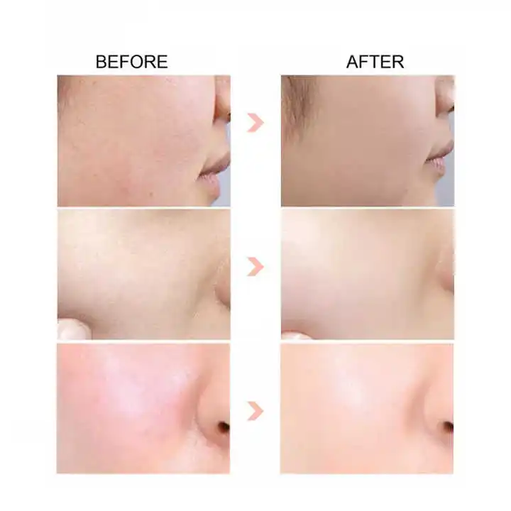 Private Label Wholesale Pure Hyaluronic Acid Facial Serum Vitamin c Niacinamide Hyaluronic Acid whitening skin care Serum