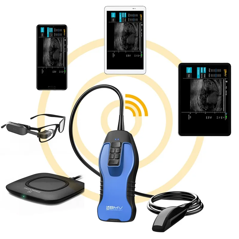 Bestscan S9 Беспроводная ультразвуковая машина для