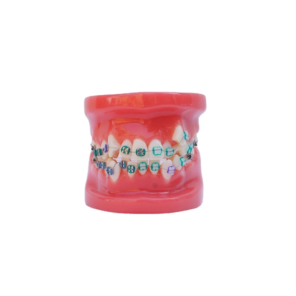 Dental Orthodontic Teeth Model With Metal and Ceramic Bracket
