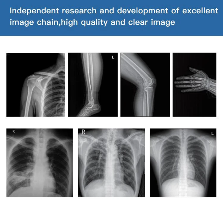 
Hot Sale Medical Imaging Equipment Portable X-Ray Machine Price Radiography System for Hospital 