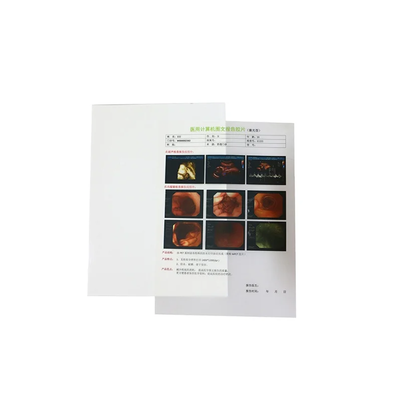 Sheet A4 A3 8X10 10X12 Inkjet Printer Use Blue Xray Film Inkjet Pet Medical Film