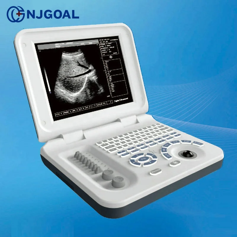 Новый продукт запуск в Китае беременность недели измерения полный цифровой 3d ультразвуковая машина цена