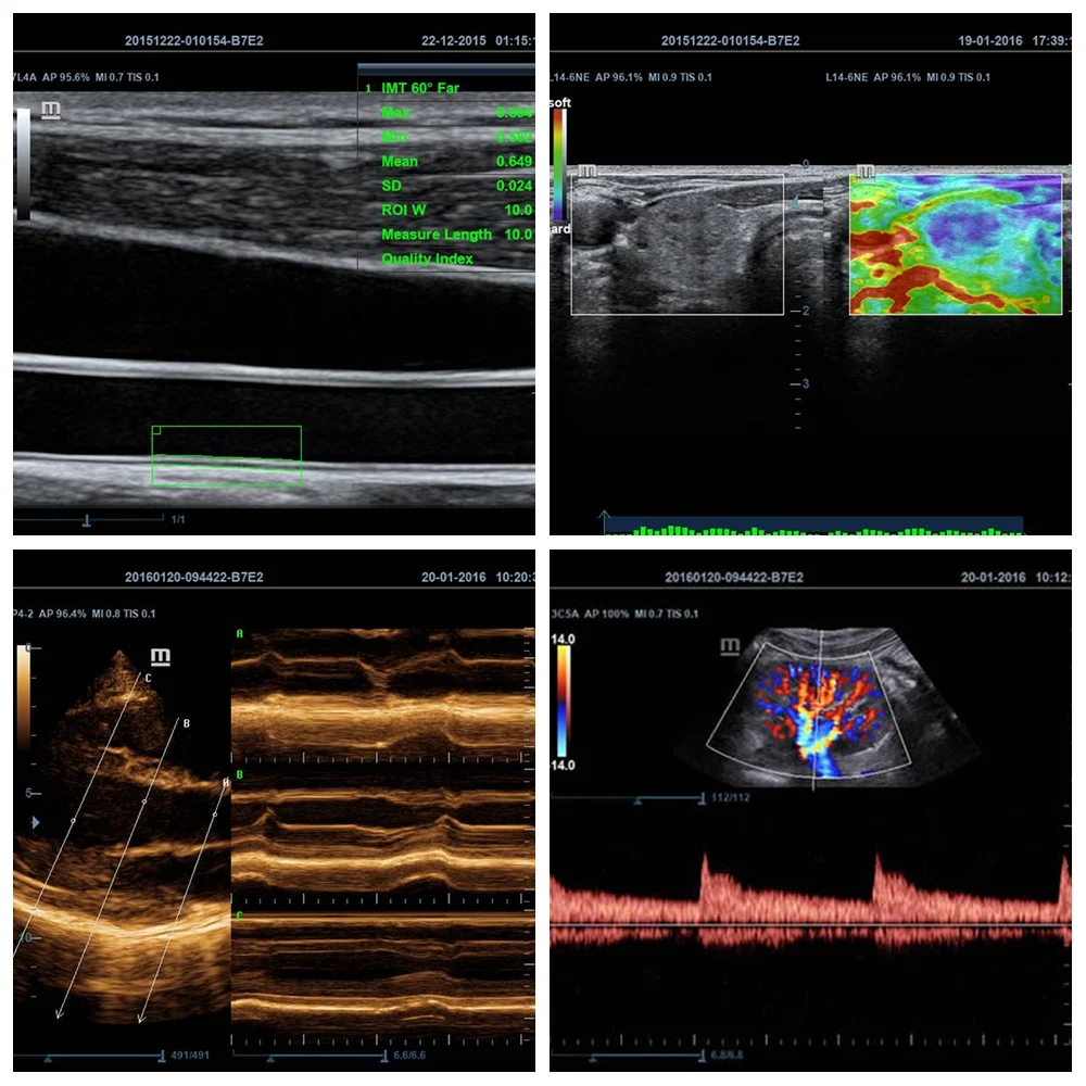 Хорошее качество Mindray DC-40 медицинский Цветной Допплер ультразвуковой аппарат сканер 4D 5D
