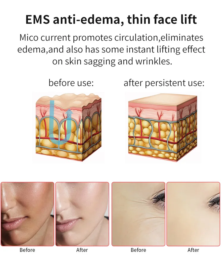 
led photon therapy neck and face lifting massager 