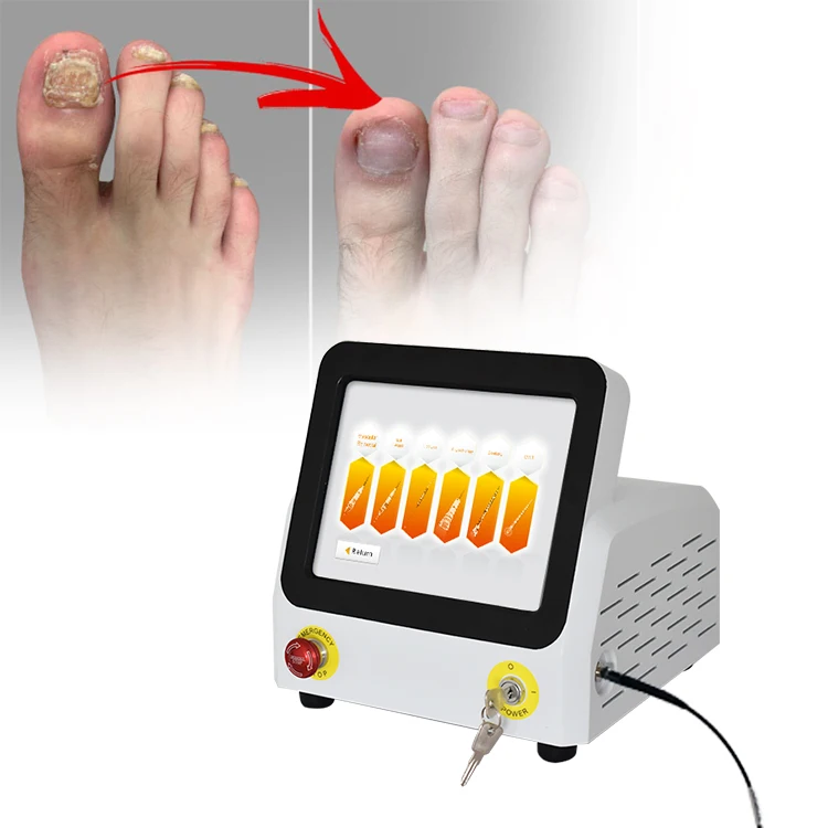 Лучший класс IV лазер онихомикоз podiatry физиотерапевтическое оборудование частная марка лечение боли при ногтях грибке