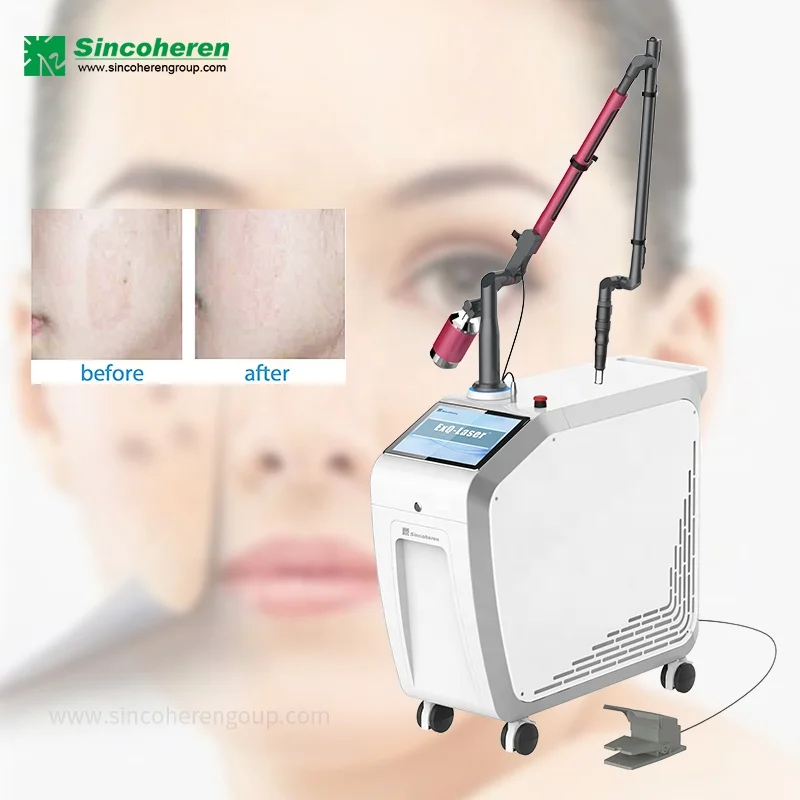 2023 q switched nd yag laser tattoo removal machine q switch laser with South Korea imported light guide arm