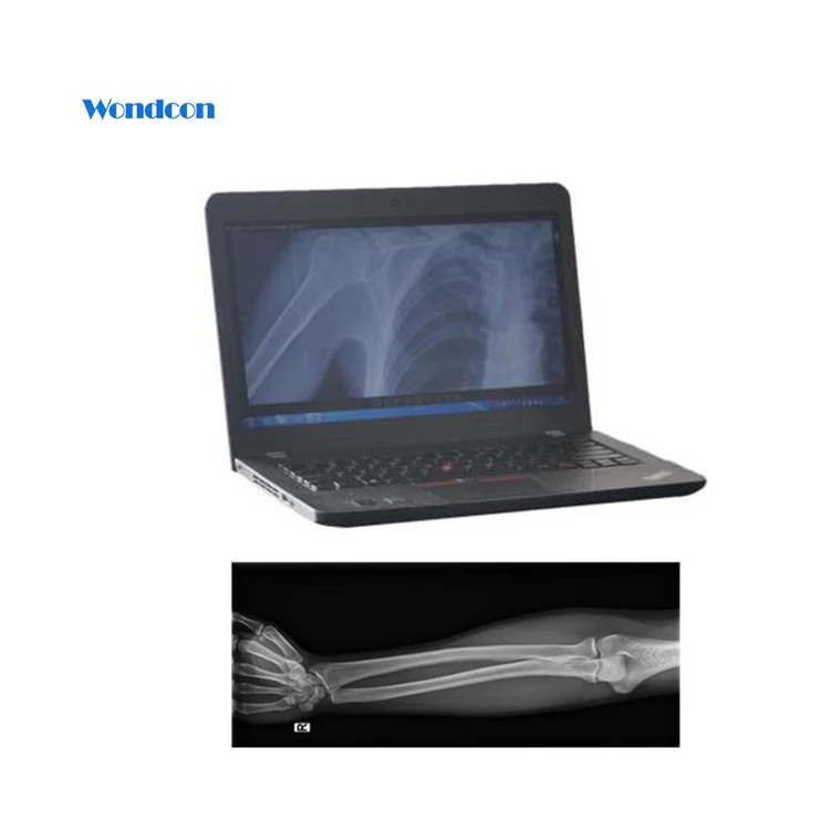 Hospital Portable X Ray Digital Dental Panoramic x-ray Machine Equipment