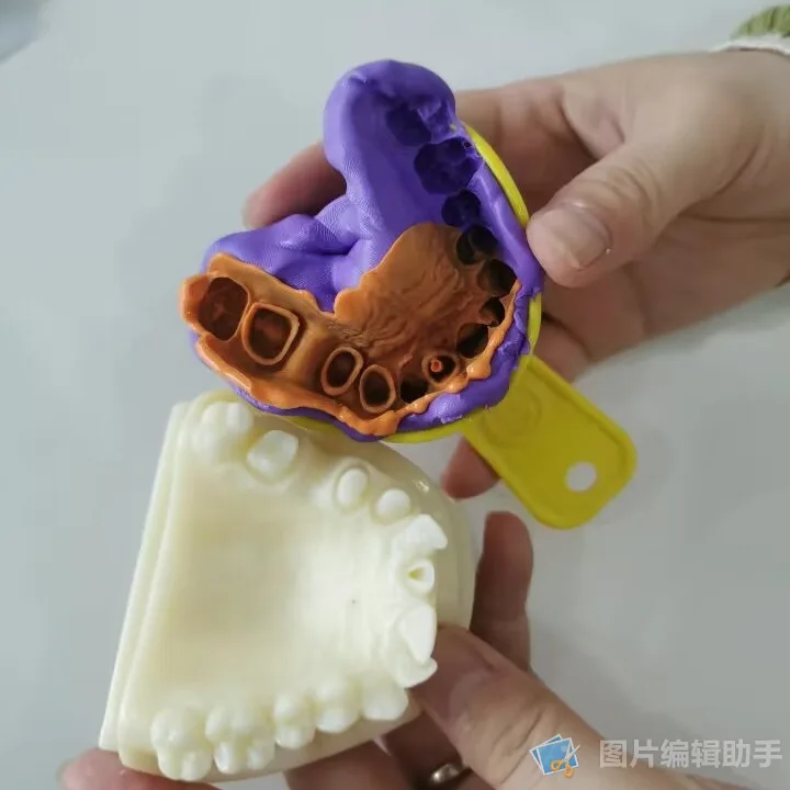 TM033 ZOGEAR High Precision Putty+Light body Dental Silicone Impression Material Kit