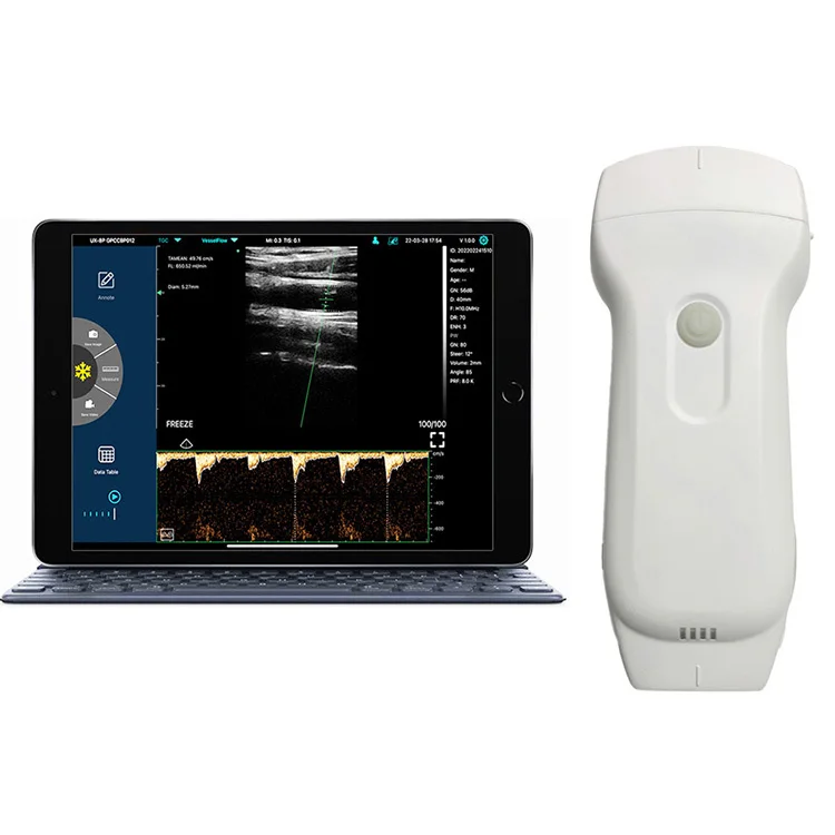 Professional Medical Devices C10RL Ultrasound Vein Illumination System, Infrared Viewer / Portable FinderClinical Analytical In