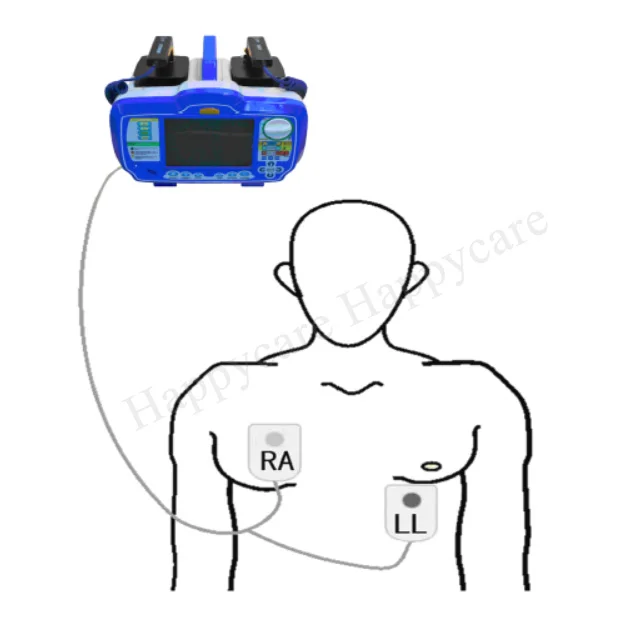  HC-C018 AED BLS дефибриллятор ACLS Monitor цена с ECG и