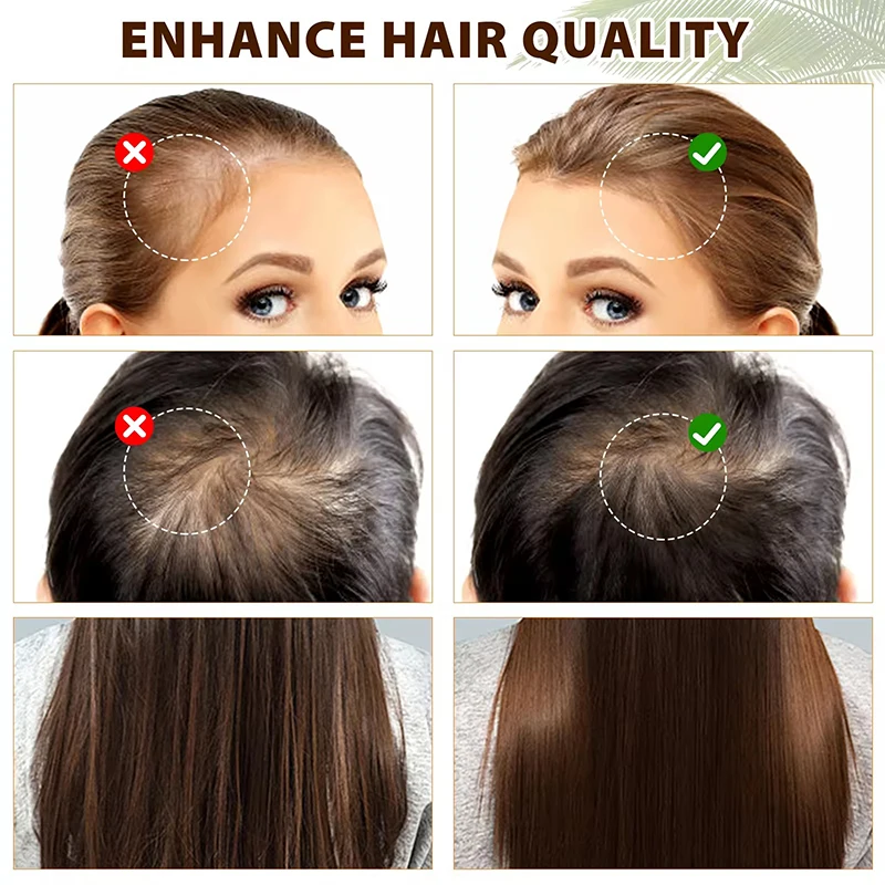 High Quality Natural Organic Formula Batana Oil Rosemary Hair Elixirs Scalp Treatment Anti Loss Hair Growth Oil