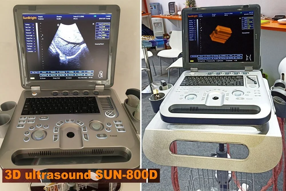  Портативный ноутбук 2D 3D цветные медицинские ультразвуковые инструменты для беременных цена на