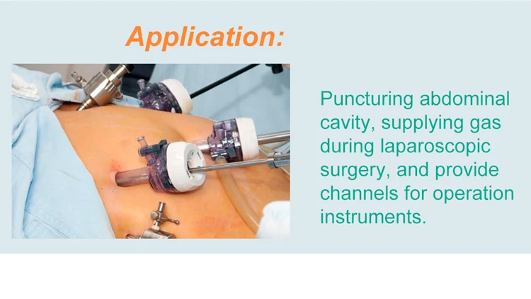 Endo Laparoscopic Disposable Trocar With Cannula 10mm To 5mm