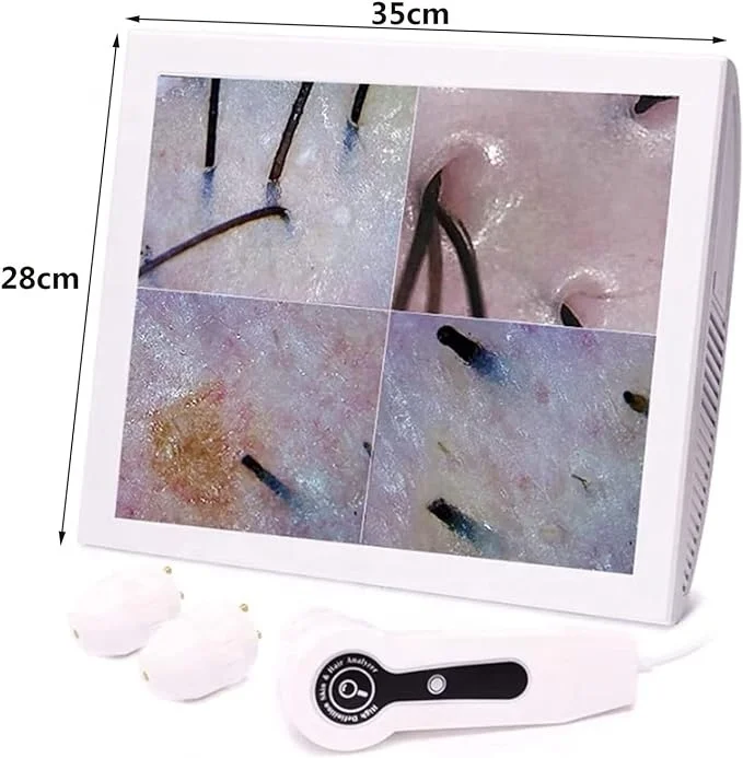 15 Inch Screen Ultra Hair Skin Analyze Hd Intelligent Beauty Salon Home  50/200 times Lens HD Scalp Hair detector Skin Analysis