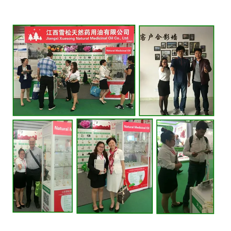 Factory Price Private Label 100% Natural Organic Rosemary Castor Oil Almond Men Women Scalp Care Serum Hair Treatment Growth Oil