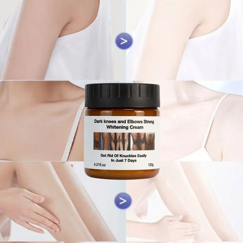 niacinamide Extreme Whitening Anti Dark Spot Aging Wrinkle Knees Elbows Strong Vitamin White Lotion Face Body Whitening Cream