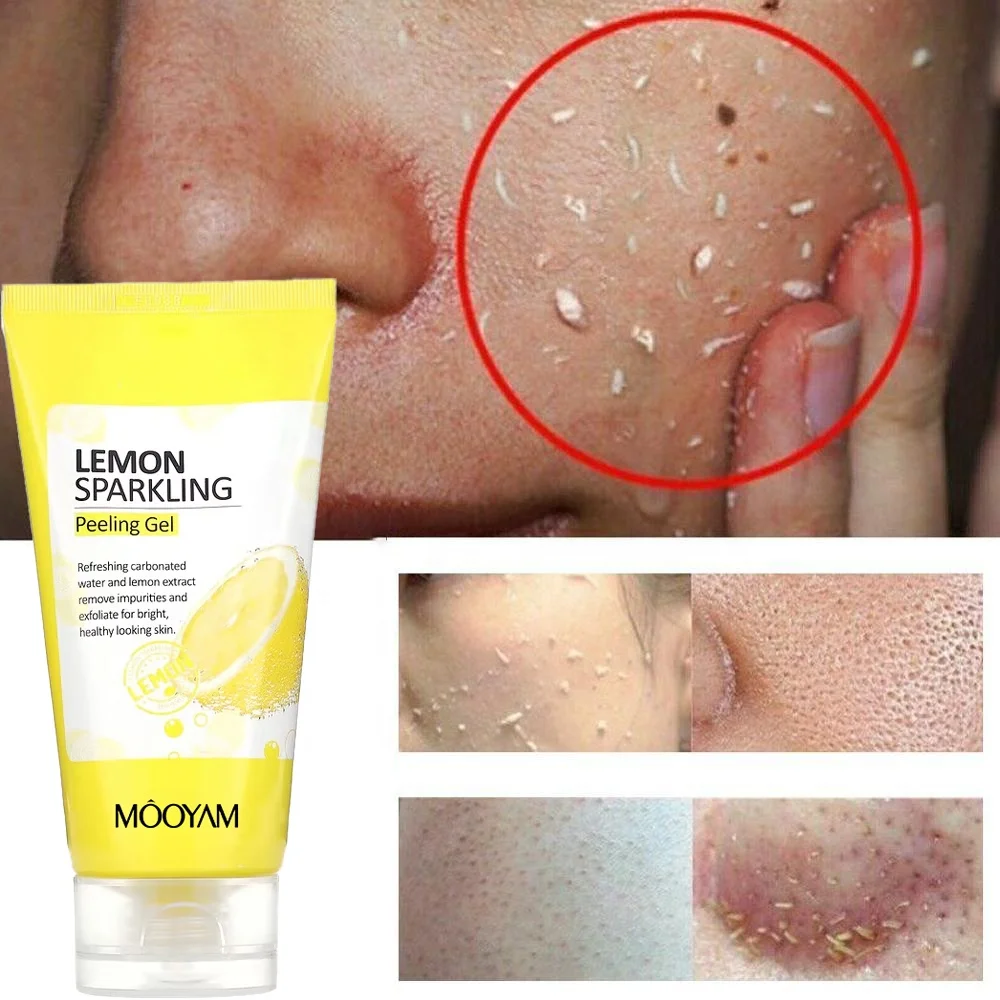 Lemon Sparkling Peeling Gel Facial Scrub Cleanser Gel Skin Care Whitening Acne Blackhead Exfoliating Gel