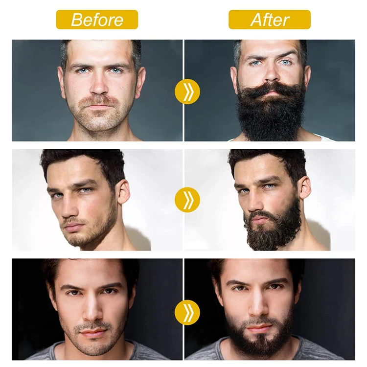 Wholesale hot selling beard growth kit for black men private label premium nature organic fast beard oil serum beard growth kit