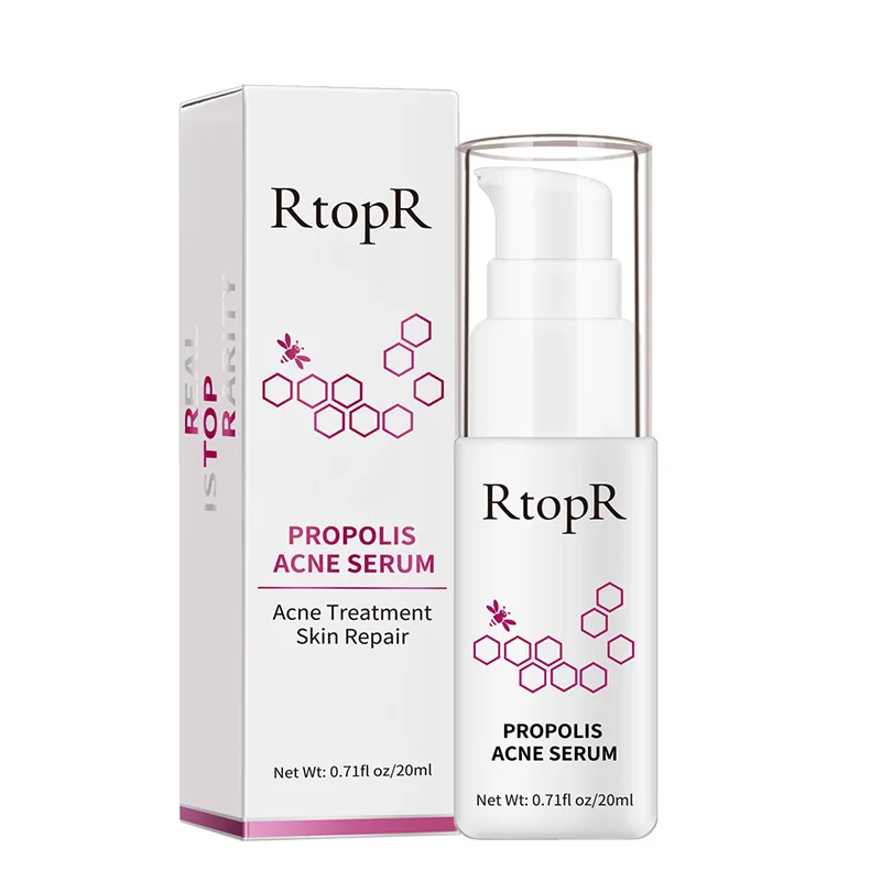 OEM and Private label Service Acne Treatment Skin Repair Propolis Acne Serum 0.71fl oz/20ml