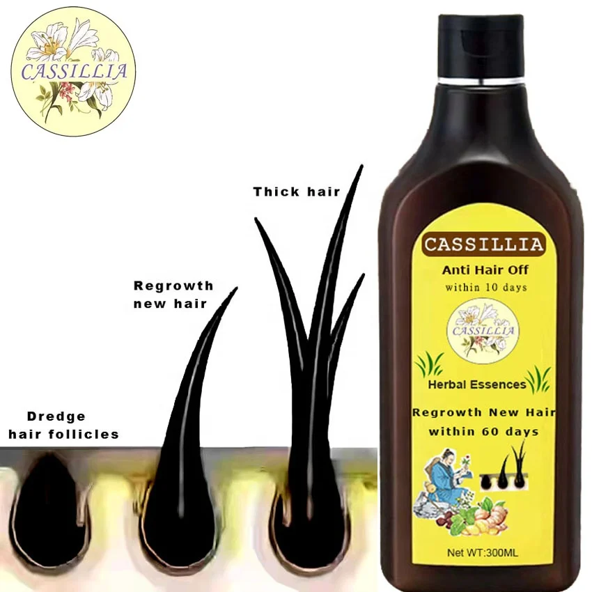 Herbal Hair Loss shampoo Treatment Growth Top Seller Organic Natural Private Label from China for Men Unisex OEM Suit Solid