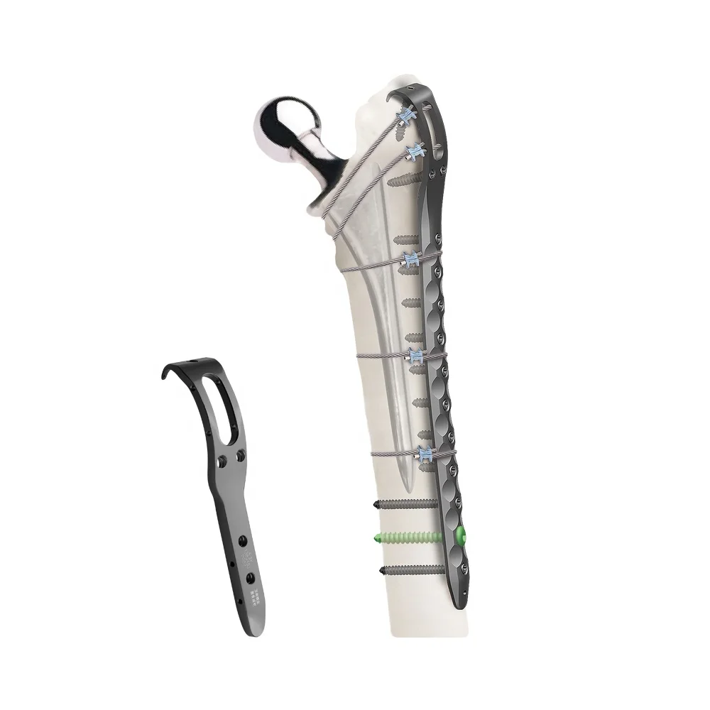 Titanium cable and locking plate Implant for Orthopedic femur fractures (Cerclage Wire)