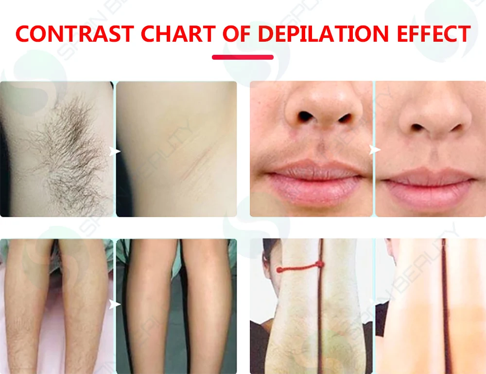 2021 newest technology 4 in 1 Fast Hair Removal 360 Magneto hair remover machine OPT/IPL laser hair removal