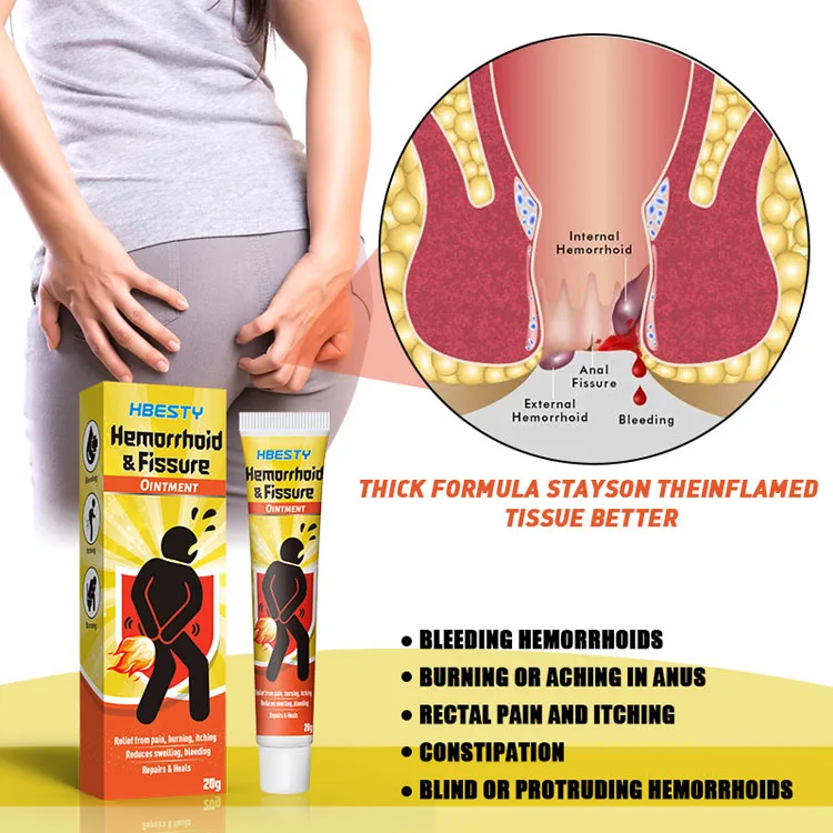 New Arrival Health Care Cream Bleeding Hemorrhoids Burning Pain Of Anus Treatment Relief Pain Hemorrhoids Ointment