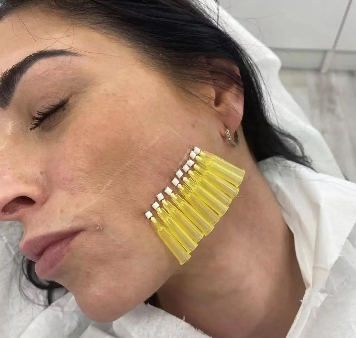 2022 New mono blunt 30g 25mm needle thread lift face eye lift pdo