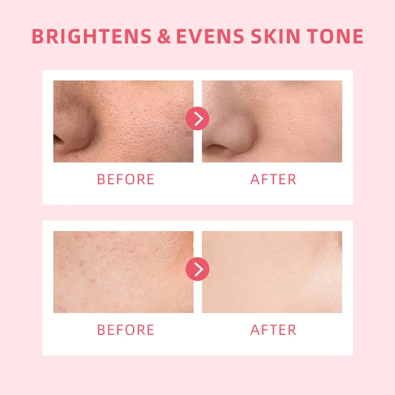 Women Beauty Skin Products Face Care Lotion for Sensitive Areas Moisturizer Whitening Cream Face