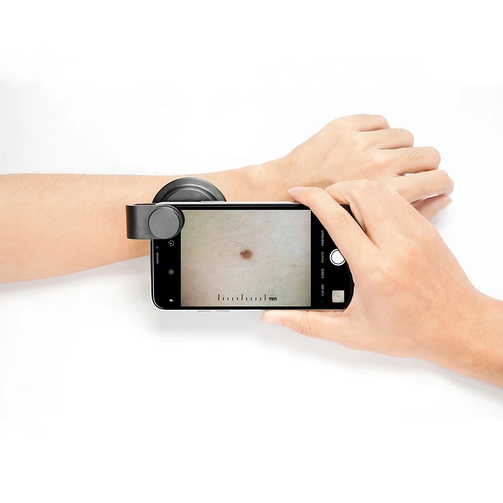 IBOOLO DE-400 photo dermatoscope for iphone and mobile phone customized dermatoscopy medical lens