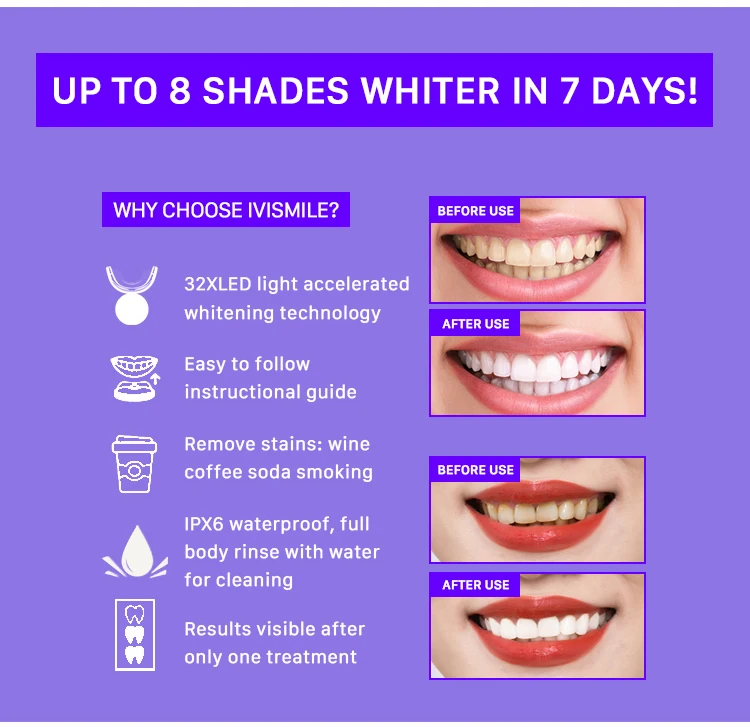 teeth whitening kit (2).jpg