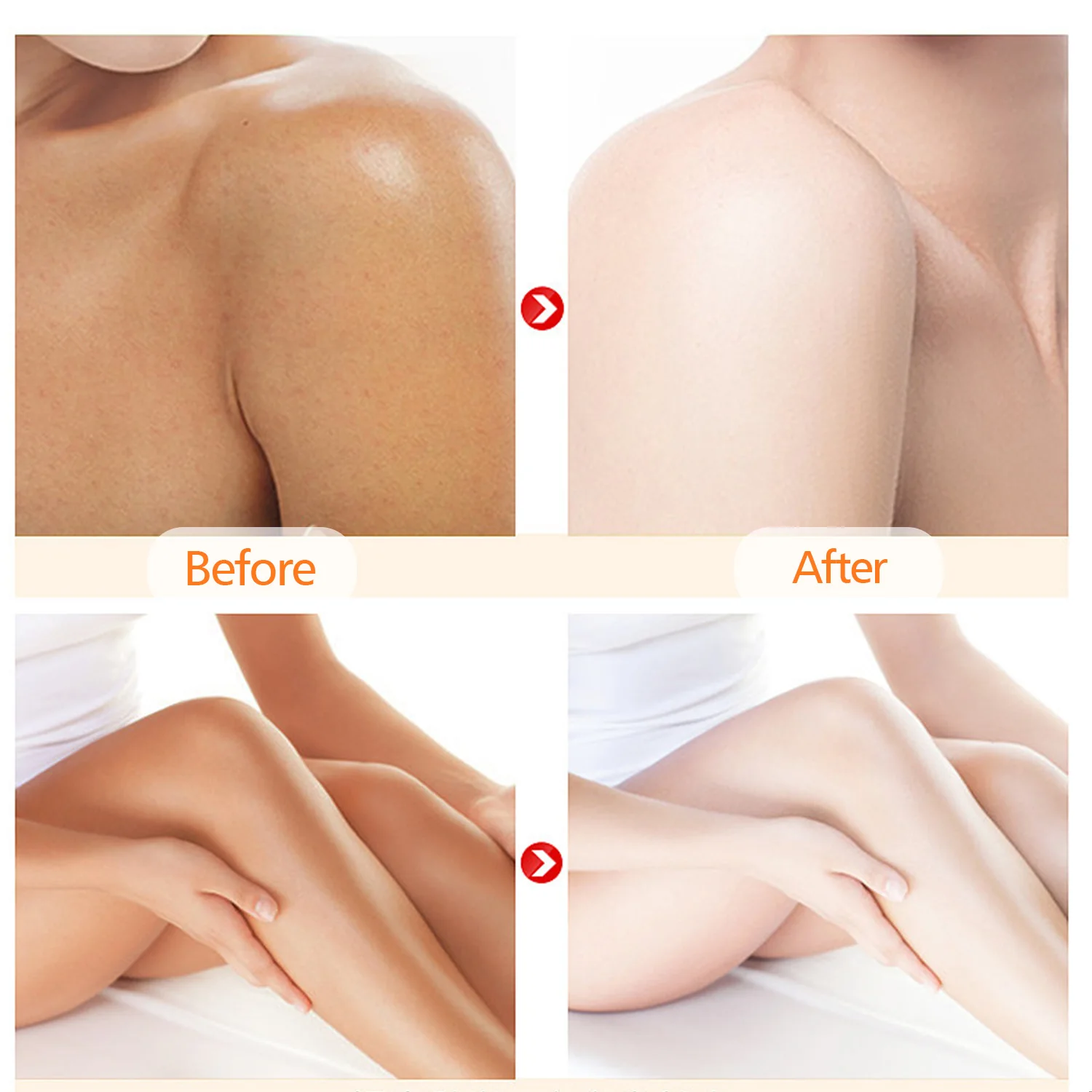 Dark Skin Bleaching Cream Skin Lightening Organic Best Glutathione Skin Whitening Body Lotion