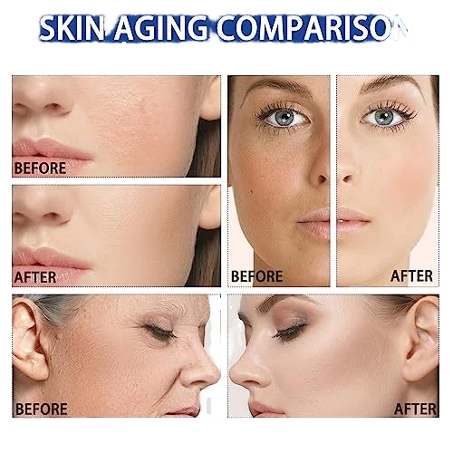 Qrdinary serum nicotinamide 10% zinc 1% hyaluronic acid B5  arbutin buffet caffeine lactate Qrdinary serum