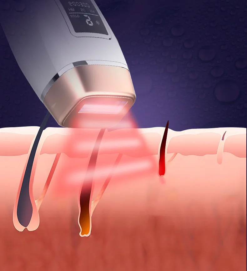 home hair laser removal Portable Painless Permanent Hair Remover 3 In 1 Ice Ipl Lazer Hair Removal