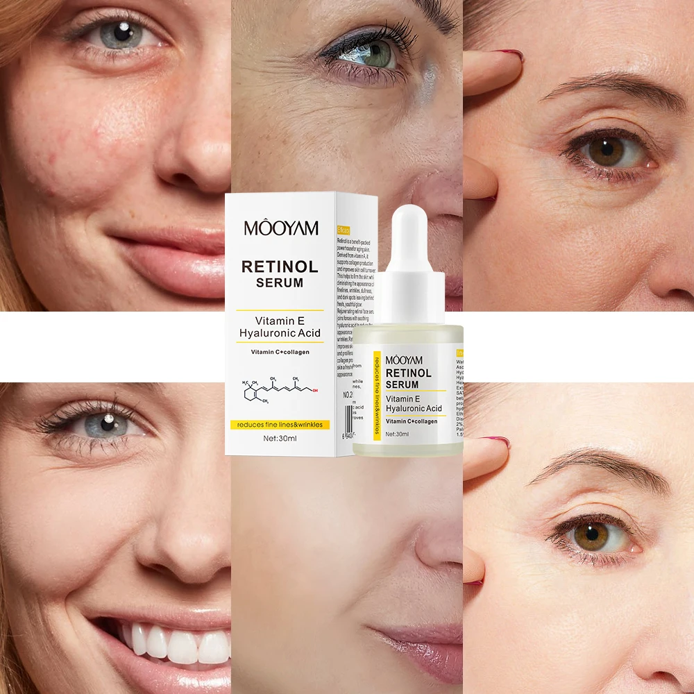 30ml Serum with Retinol Vitamin E Hyaluronic Acid Promote Collagen Production Reduce Wrinkles Shrink Pores MOOYAM Retinol Serum
