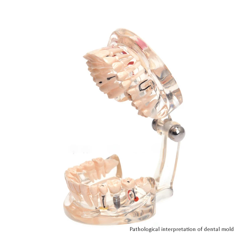 High quality lab typodont dental model practice dental implant model