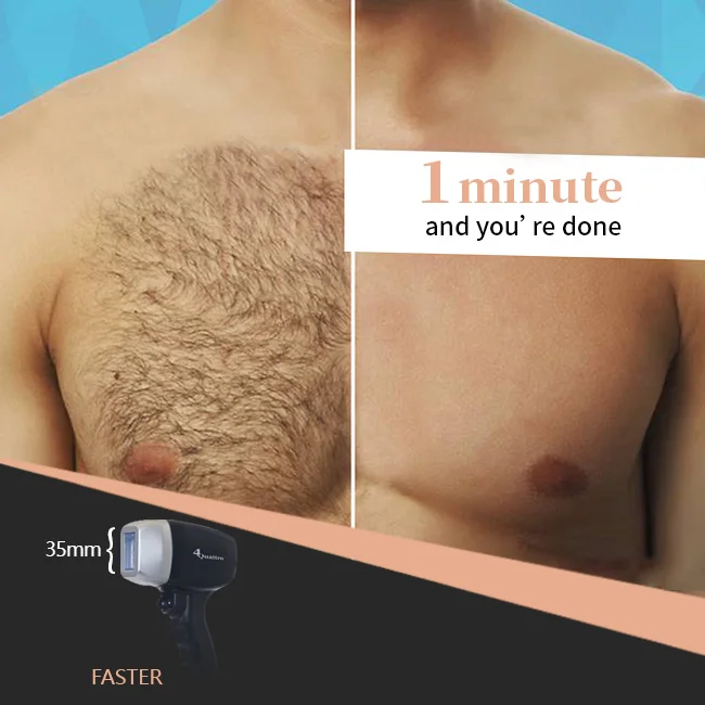 Laser Beauty Equipment Hair Removal Machine Diode Laser 755 808 1064 Diode Laser