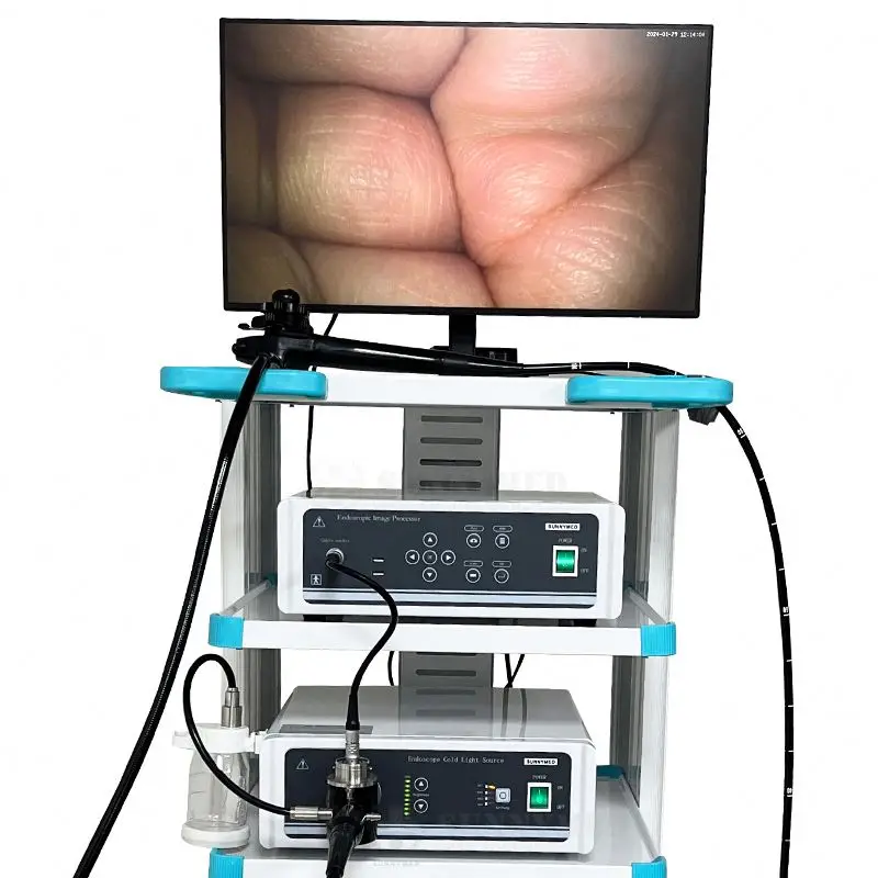 SY-PGC048 Electronic Colonoscope Medical Flexible Video Enodoscope Gastroscope Colonoscope Set