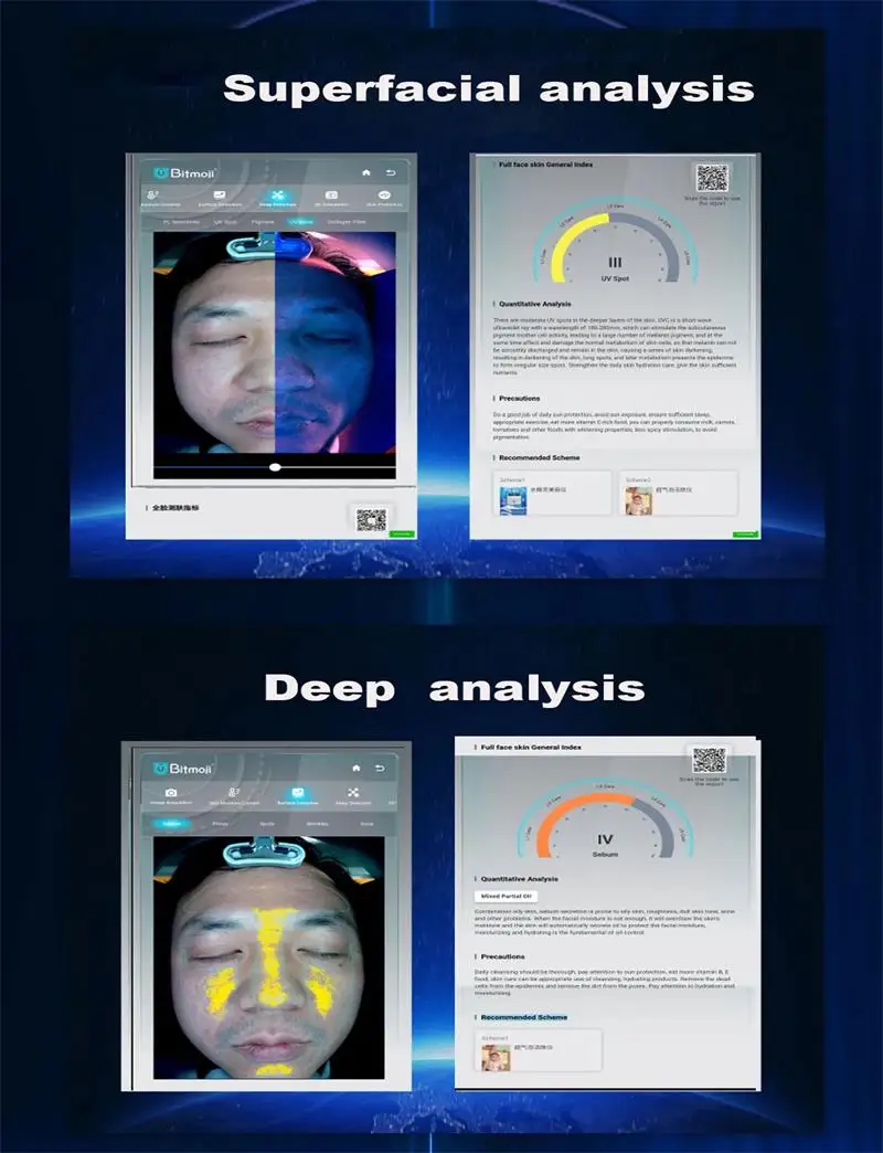 3D Skin Analyer (4).jpg