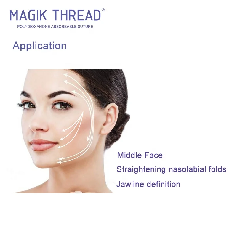 High-level 19G 100mm L blunt needle hot new products facial cog 4d pdo thread